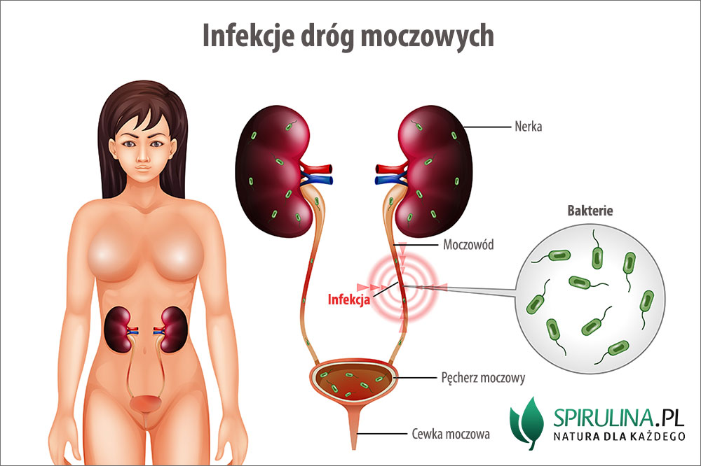 wirlorazkwe pieluchy dla psa