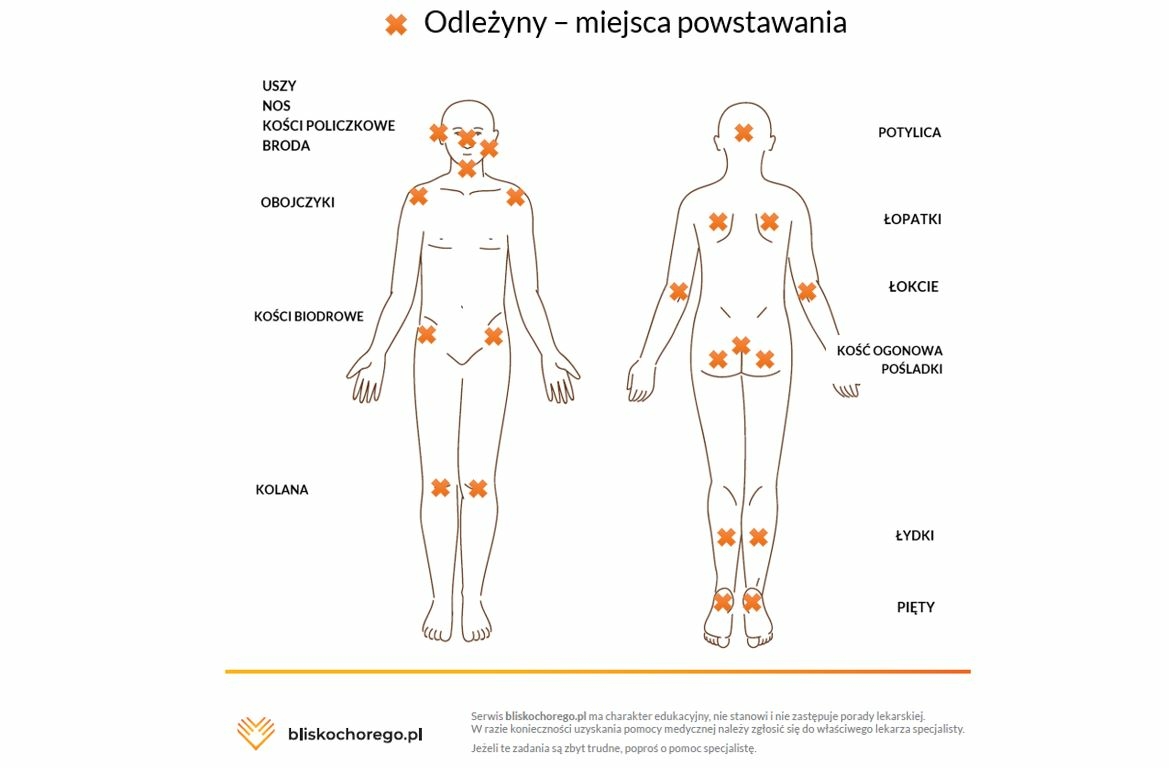 stokrotka olsztyn pieluchy