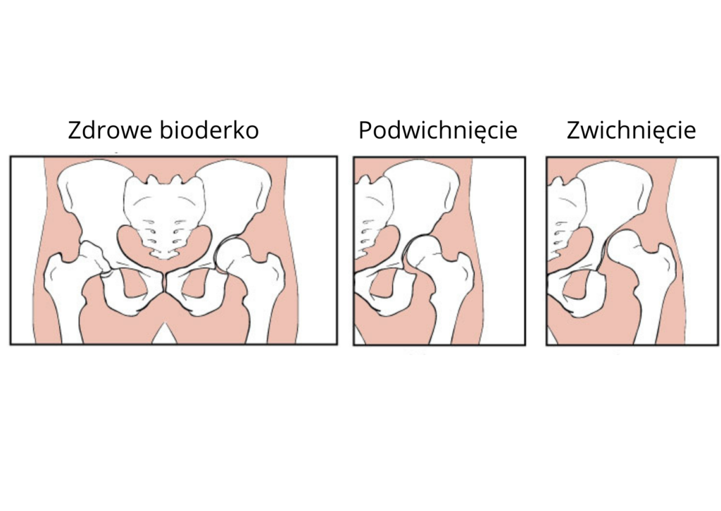 w jakim rozmiarze kupić pieluchy tetrowe